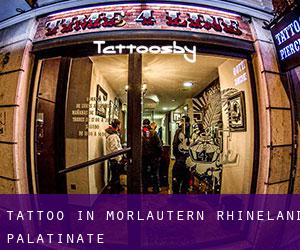 Tattoo in Morlautern (Rhineland-Palatinate)
