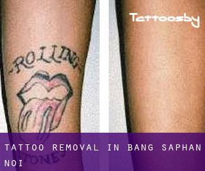 Tattoo Removal in Bang Saphan Noi
