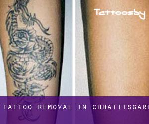 Tattoo Removal in Chhattisgarh