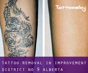 Tattoo Removal in Improvement District No. 9 (Alberta)