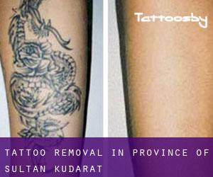 Tattoo Removal in Province of Sultan Kudarat