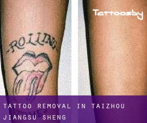 Tattoo Removal in Taizhou (Jiangsu Sheng)