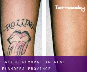 Tattoo Removal in West Flanders Province